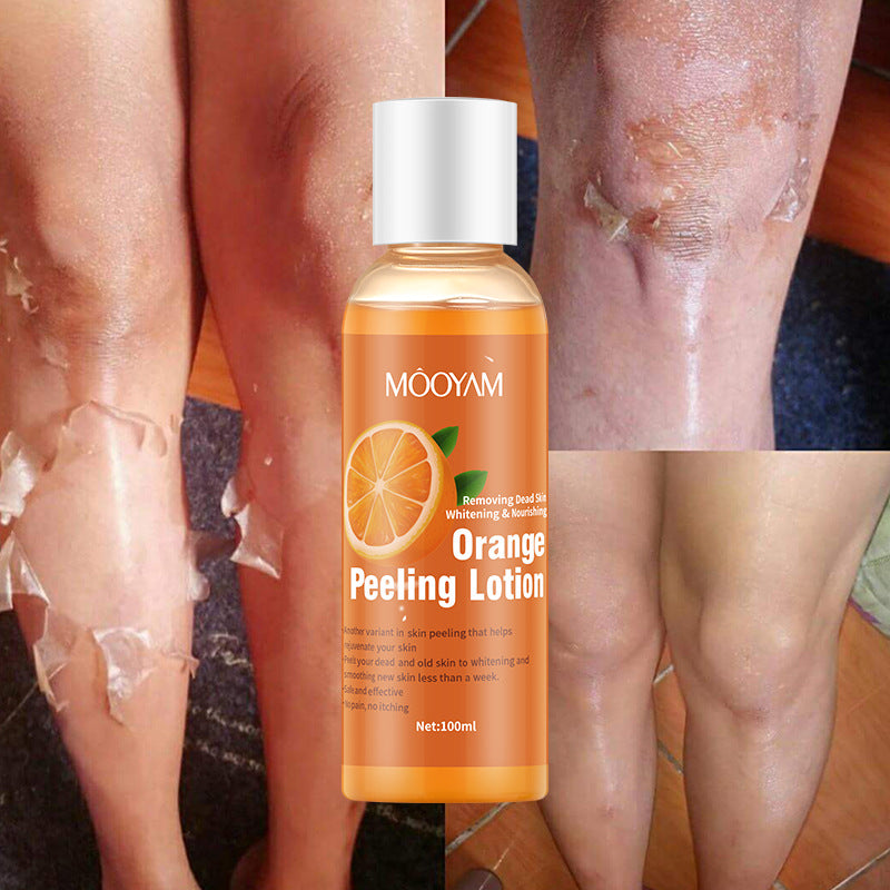 Orange Peel Lotion Peeling Oil Body Lotion Gentle Exfoliation - SELFTRITSS