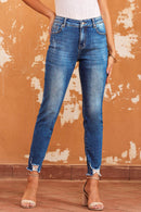 Blue Raw Hem Ankle-length Skinny Jeans - SELFTRITSS